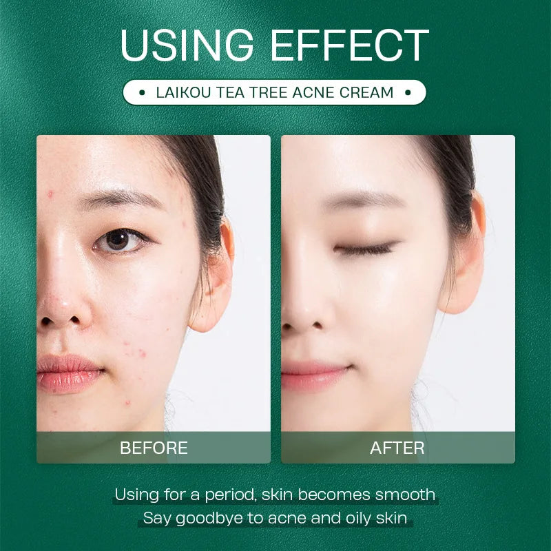 Crème Visage Tea Tree LAIKOU – Soin Ciblé Peau Nette - vue produit 3