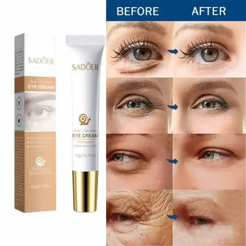 Crème Contour des Yeux Effet Lift Instantané – Anti-Poches & Anti-Cernes - vue produit 6