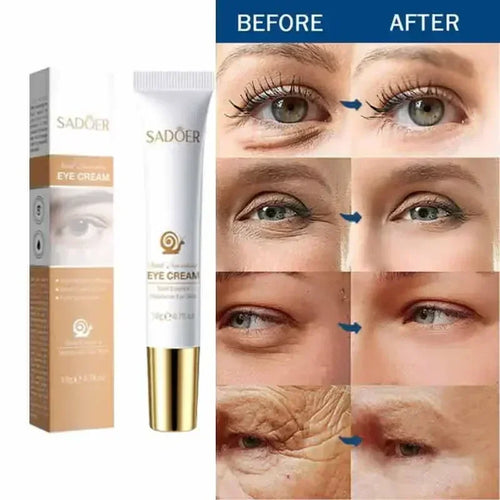 Crème Contour des Yeux Effet Lift Instantané – Anti-Poches & Anti-Cernes - vue produit 6